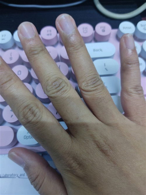 Hand cream recos for dry skin