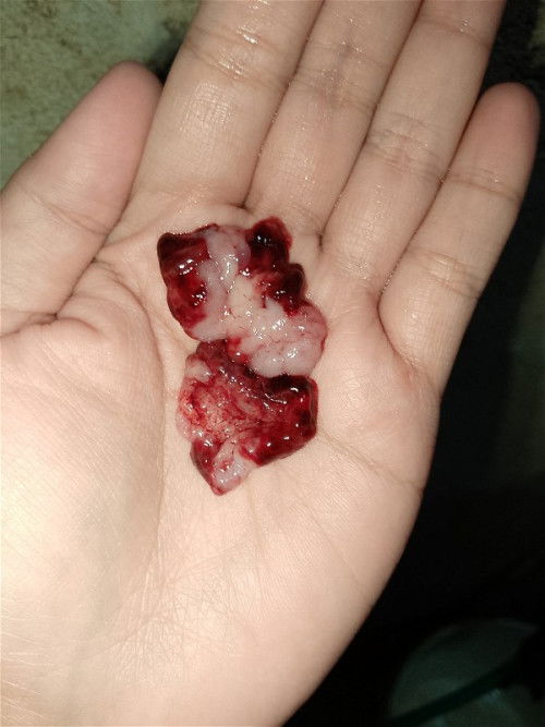 Baka alam nyo po kung ano ito ?