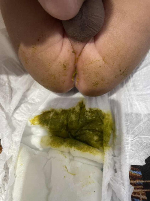 Pup Bayi Hijau