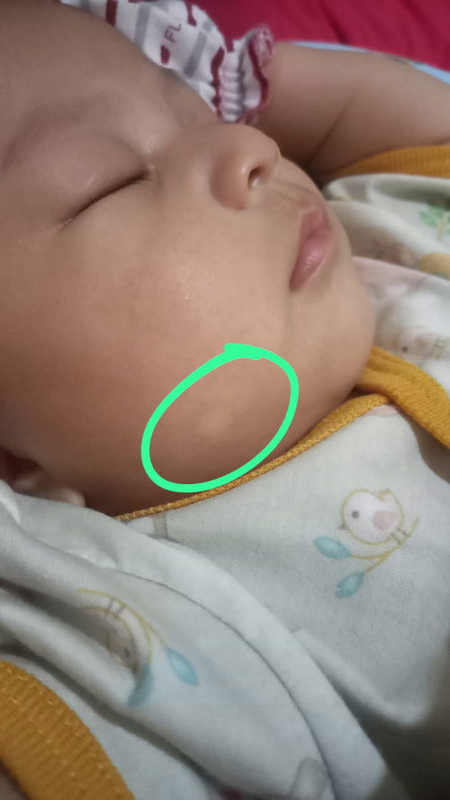 putih di pipi apakah panu?