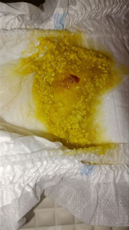 Pup bayi asi + sufor
Maaf sebelumnya sedikit jorok🙏