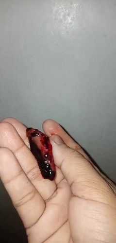 Nakunan po ba ako?