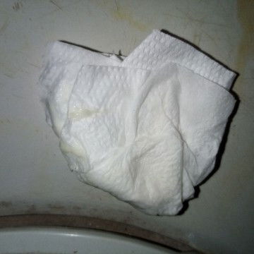 เหมือนจะเป็นตกขาว