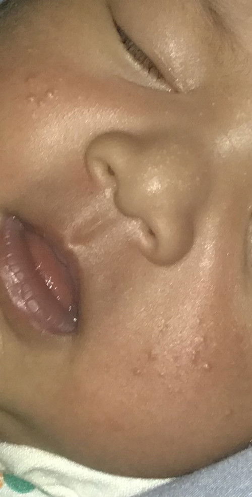 Bintik-bintik pada wajah