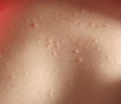 Skin changes