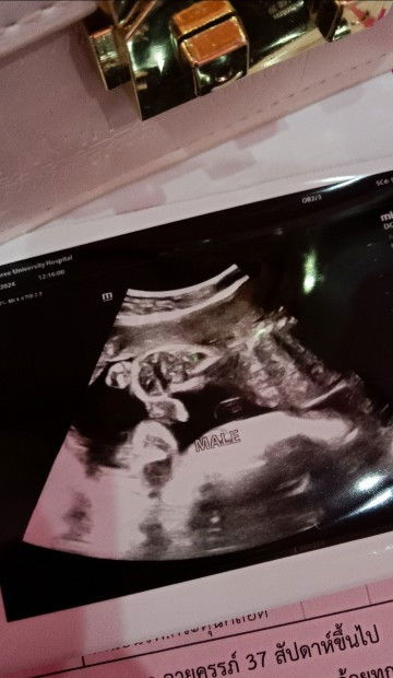 มาดูเพศลูกกัน