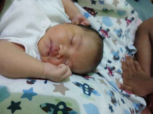 Kepala bayi baru lahir ada benjolan