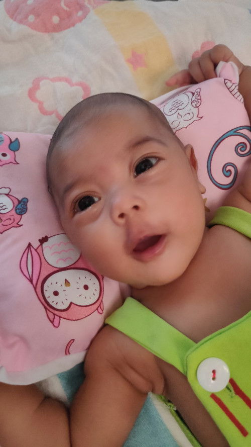 โกนผมไฟ ผมขึ้นช้ามาก