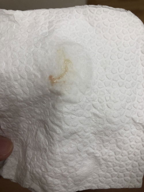 Mucus? #FTM #37 weeks