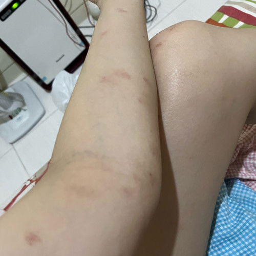 Usia 14 minggu BB turun 6 kg