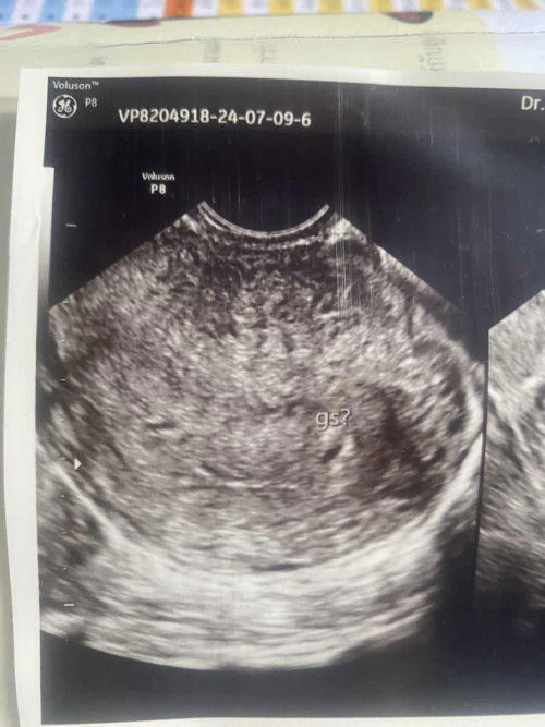 ขออนุญาติสอบถามนะคะ