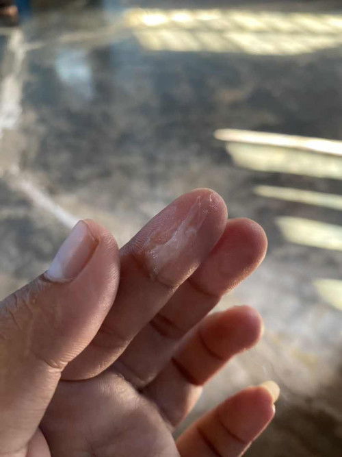 Keluar lendir sedikit sudah 5 hari