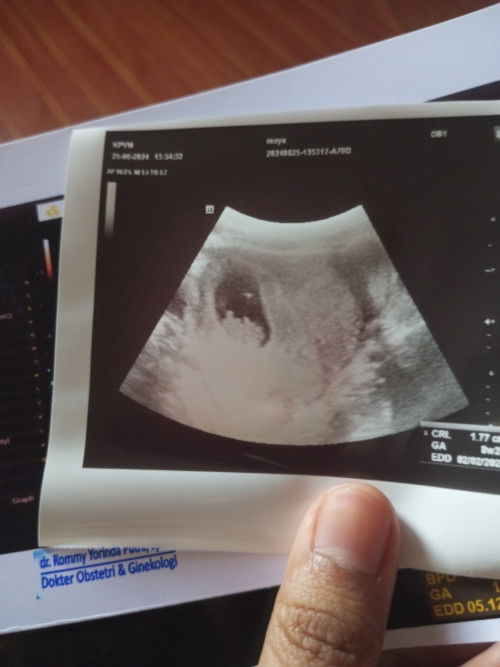 Msih suka keluar flek dr usia 7 Minggu dan usia kandungan sekarang udah 10 Minggu .