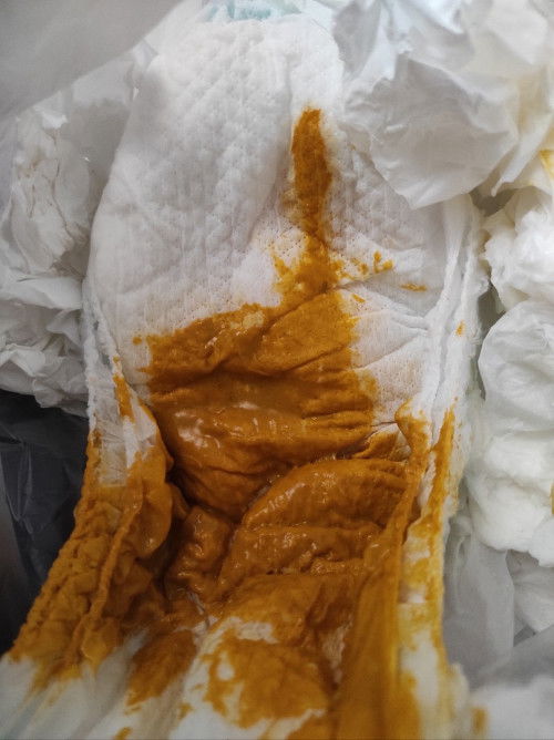 Pup bayi 2 bulan agak cair