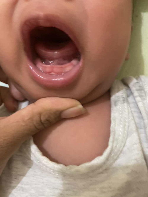 สอบถามหน่อยค่ะแม่ๆ