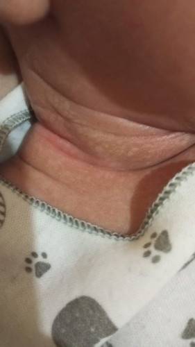 Mau nanya, ini kulitnya knpa yah? Cmn sekintaran leher aja baru" Kulitnya gituj, sabun johnsons