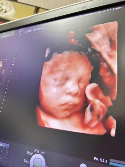 ยกความดีให้นมฮูเร่รสช็อกโกแลต