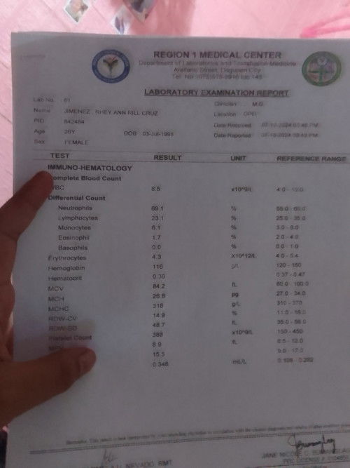 Paano basahin to mga mii