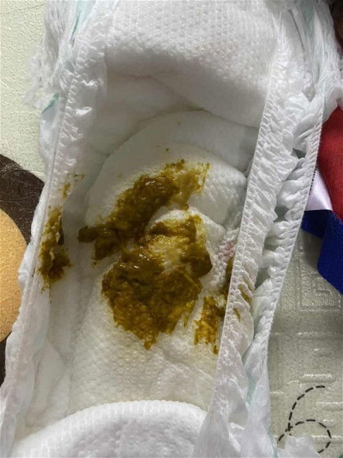 najis baby cirit or tak