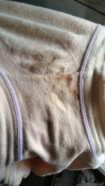 BERCAK DARAH SETELAH HB