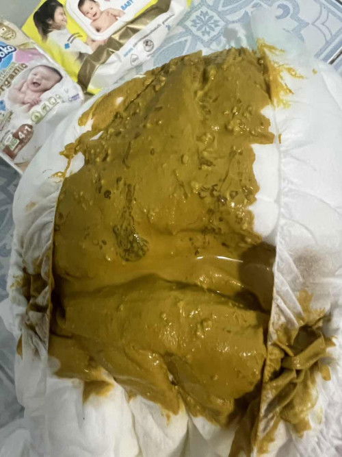 ถ่ายมีมูกสีน้ำตาลๆ