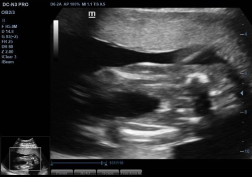 GENDER BABY