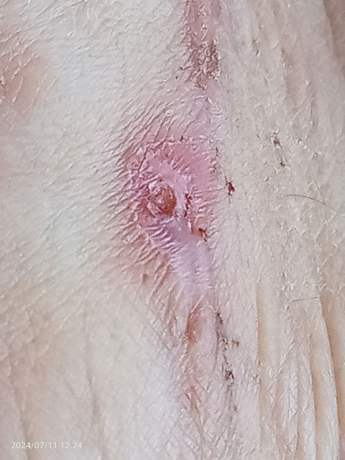 Nak tnya akak ² bersalin czerr