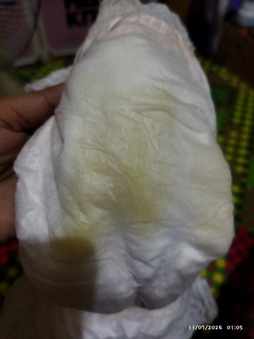 Warna urine bayi 4 bulan
