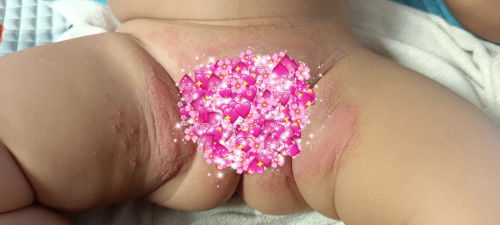 Ruam popok bayi 6 bulan