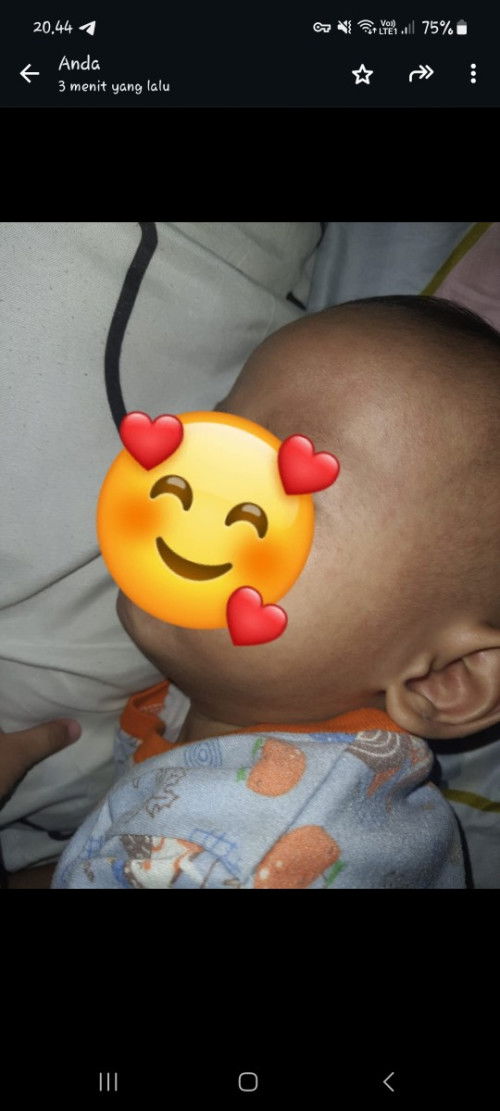 Ruam Merah Setelah Demam