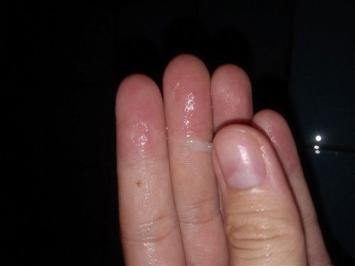 ท้อง 38W+2 อยากทราบว่าใช่มูกใกล้คลอดมั้ยคะ มันอันตรายมั้ย #ขอคำแนะนำหน่อยค่ะ ขอรยกวนด้วยค่ะ