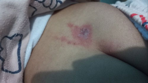 Ini penyebabnya apa ya bun?