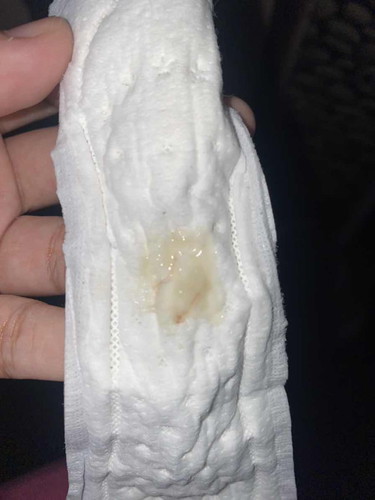 mucus plug ke ni?
