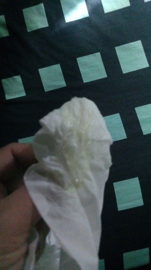 Keluar keputihan banyak usia kehamilan 38weeek