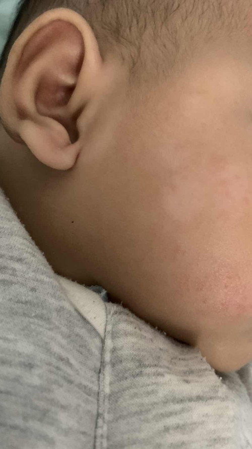 kulit bayi
