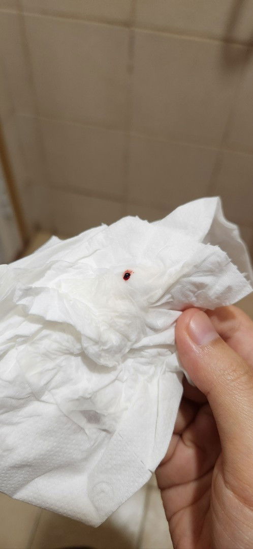 tiny clot after pee