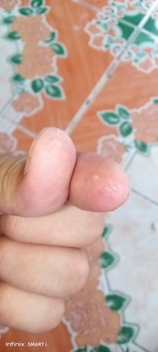 ขออภัยในรูปภาพ