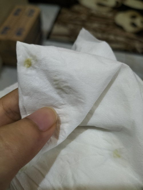 keputihan berwarna kuning agak hijau saat hamil 8 weeks