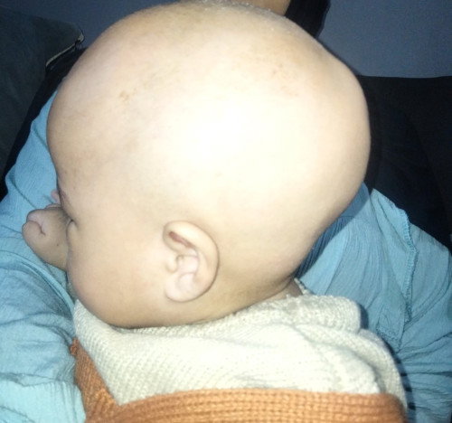 Kepala bayi peyang
