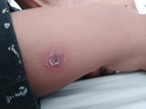 Ano kaya ito lumalaki sya sa 2 year old son ko
