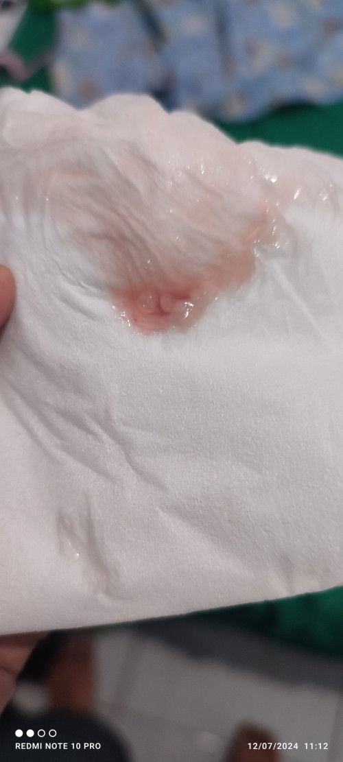 Hamil 36 minggu 5 hari