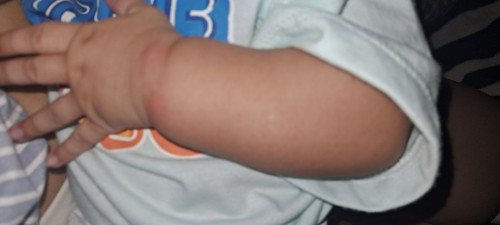 May tumubo sa kamay ni lo