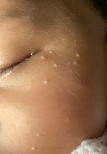 Kulit muka bayi
