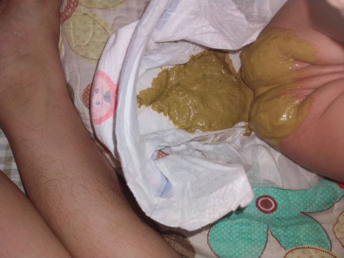 Poop ni baby 3 months old