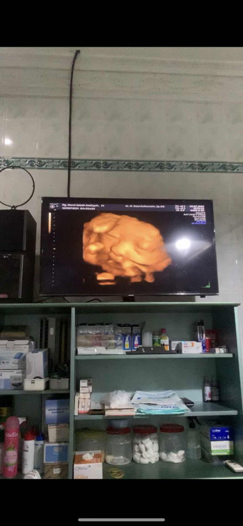 HPL 2 september 2024