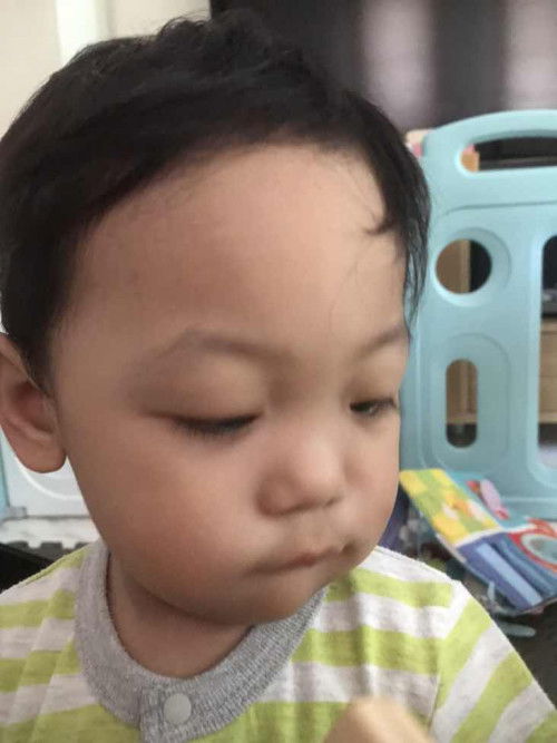 ลูกชอบกัดและดูดปากล่างเกิดจากอะไร และจะหายไปไหมคะ