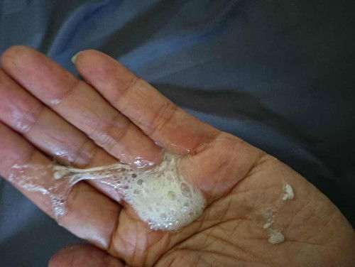 แบบนี้ปกติไหม