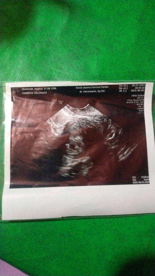 5week kantung nya saja