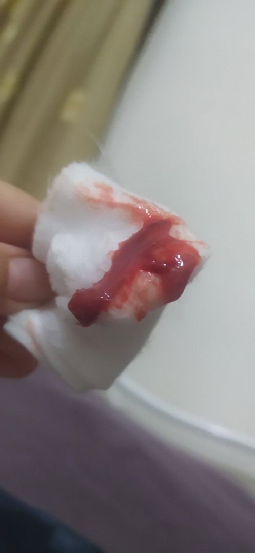 Darah period pucat ke darah penyakit eh