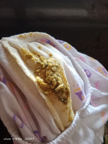 Hello po ask kolang po kung normal po ba ang ganitong poops ng baby ?